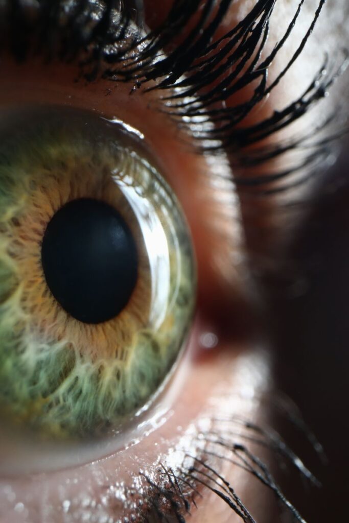 Wollongong Iridology